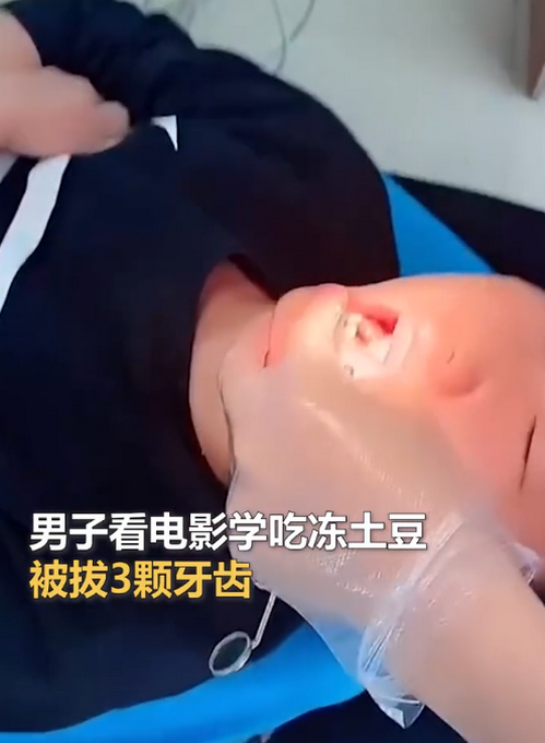 看完《长津湖》，男子学吃冻土豆后拔3颗牙……